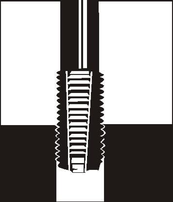 BPA000138047